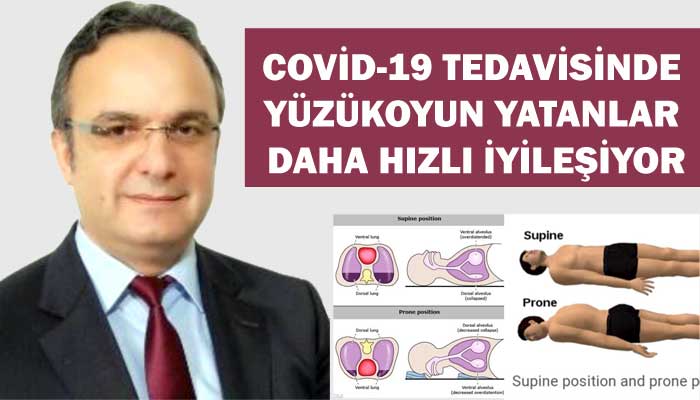 COVİD-19 TEDAVİSİNDE YÜZÜKOYUN YATANLAR DAHA HIZLI İYİLEŞİYOR