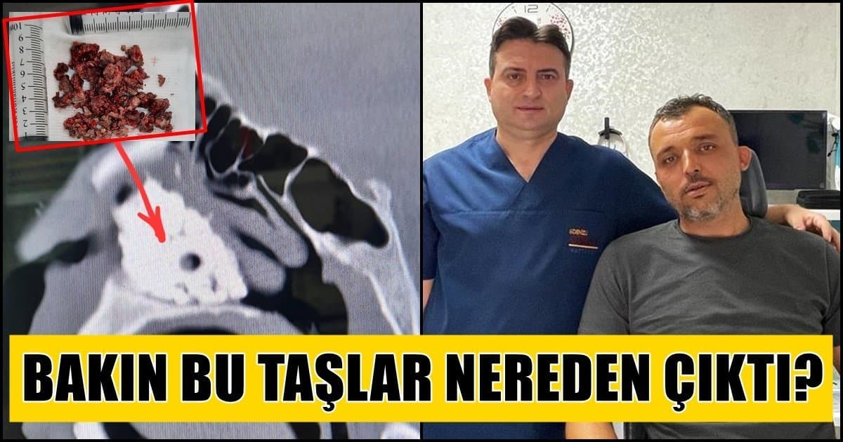 Safra Kesesi, Böbrek Taşı Duyduk da…