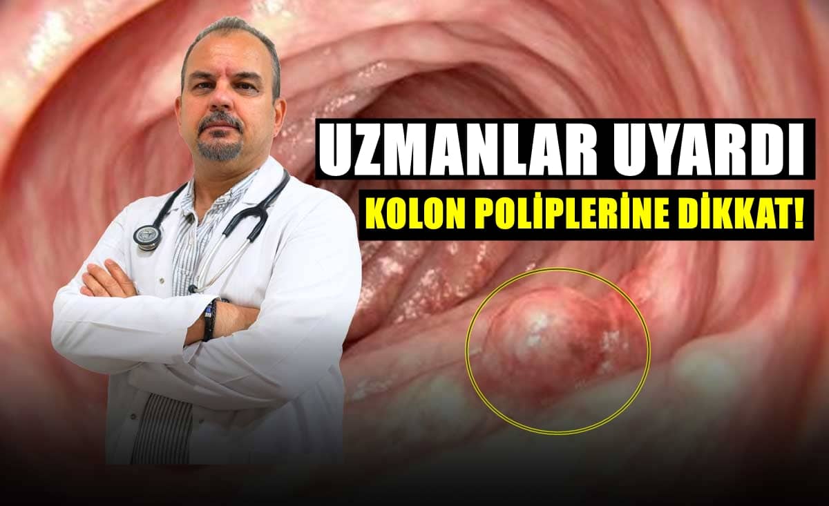 Uzman Dr. Ekici: 50 Yaş Üstü Herkesin Düzenli Kolonoskopi Yaptırması Çok Önemli…