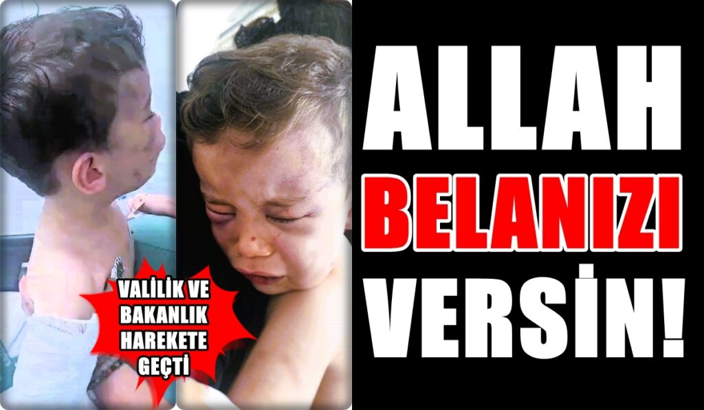 Denizli’de Tüyler Ürperten Olay: Çocuğunu Bu Hale Getiren Sevgilisini Korumaya Çalıştı…