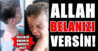 Denizli’de Tüyler Ürperten Olay: Çocuğunu Bu Hale Getiren Sevgilisini Korumaya Çalıştı…